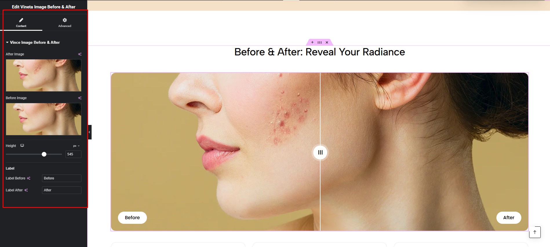 Vineta Image Before & After Customize